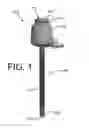 Fig. 02 - Trocar assembly with a cleaning element for use during a laparoscopic procedure