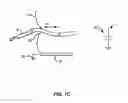 Fig. 03 - Systems and methods for determining the state of motion of an instrument