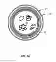 Fig. 04 - Systems and methods for determining the state of motion of an instrument