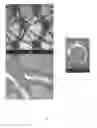 Fig. 06 - Temporarily stiffened mesh prostheses