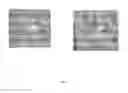 Fig. 07 - Temporarily stiffened mesh prostheses