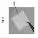 Fig. 02 - Method for use of a double-structured tissue implant for treatment of tissue defects