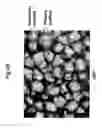 Fig. 07 - Method for use of a double-structured tissue implant for treatment of tissue defects