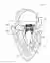 Fig. 01 - Mitral valve prosthesis delivery system