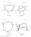 Fig. 06 - Mitral valve prosthesis delivery system