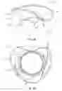 Fig. 07 - Mitral valve prosthesis delivery system