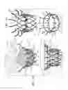 Fig. 02 - Prosthetic valve with aligned inner and outer frames