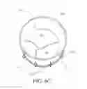 Fig. 07 - Heart valve