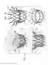 Fig. 02 - Prosthetic valve with radially-deflectable tissue anchors