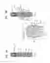 Fig. 03 - Prosthetic valve with radially-deflectable tissue anchors