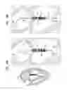 Fig. 08 - Prosthetic valve with radially-deflectable tissue anchors
