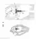 Fig. 11 - Prosthetic valve with radially-deflectable tissue anchors