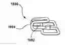 Fig. 01 - Delivery system having a short capsule segment and a cinch mechanism and methods of use thereof