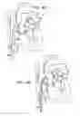 Fig. 08 - Annuloplasty ring delivery catheters