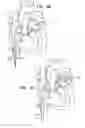Fig. 09 - Annuloplasty ring delivery catheters