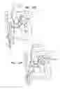 Fig. 28 - Annuloplasty ring delivery catheters