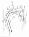 Fig. 44 - Annuloplasty ring delivery catheters