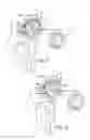 Fig. 08 - Prosthetic implant support structure