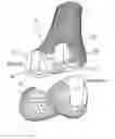 Fig. 01 - Total knee replacement implant based on normal anatomy and kinematics