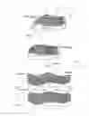 Fig. 05 - Total knee replacement implant based on normal anatomy and kinematics