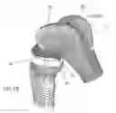 Fig. 07 - Total knee replacement implant based on normal anatomy and kinematics