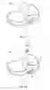 Fig. 06 - Tibial prosthesis with tibial bearing component securing feature