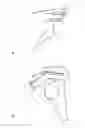 Fig. 01 - Orthopaedic shoulder implant