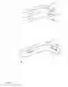 Fig. 08 - Orthopaedic shoulder implant