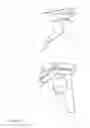 Fig. 13 - Orthopaedic shoulder implant