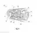 Fig. 06 - Subtalar implants