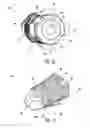 Fig. 07 - Subtalar implants