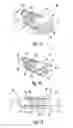 Fig. 09 - Subtalar implants