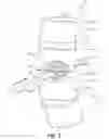 Fig. 03 - Implant with bone contacting elements having helical and undulating planar geometries