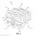 Fig. 05 - Implant with bone contacting elements having helical and undulating planar geometries