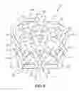 Fig. 09 - Implant with bone contacting elements having helical and undulating planar geometries