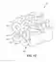 Fig. 13 - Implant with bone contacting elements having helical and undulating planar geometries