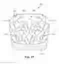 Fig. 17 - Implant with bone contacting elements having helical and undulating planar geometries