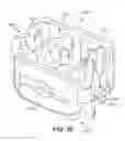 Fig. 29 - Implant with bone contacting elements having helical and undulating planar geometries
