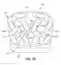 Fig. 31 - Implant with bone contacting elements having helical and undulating planar geometries