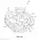 Fig. 33 - Implant with bone contacting elements having helical and undulating planar geometries