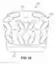 Fig. 34 - Implant with bone contacting elements having helical and undulating planar geometries