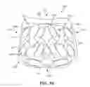 Fig. 09 - Corpectomy implant