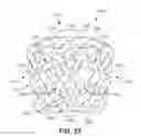 Fig. 22 - Corpectomy implant