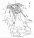 Fig. 40 - TRIAL DEVICE FOR TESTING A SIZE OF A SPINAL DISC SPACE