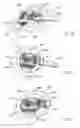 Fig. 09 - Stabilized, 4 beam intervertebral scaffolding system