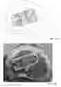 Fig. 18 - Stabilized, 4 beam intervertebral scaffolding system
