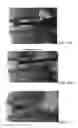 Fig. 19 - Stabilized, 4 beam intervertebral scaffolding system