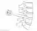Fig. 01 - Method and apparatus for minimally invasive insertion of intervertebral implants