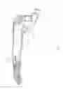 Fig. 02 - MOUNTING STRUCTURE FOR GENERAL PROSTHETIC FINGER OF PROSTHETIC HAND