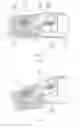 Fig. 04 - MOUNTING STRUCTURE FOR GENERAL PROSTHETIC FINGER OF PROSTHETIC HAND
